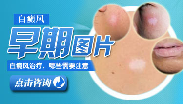 Ӧô
